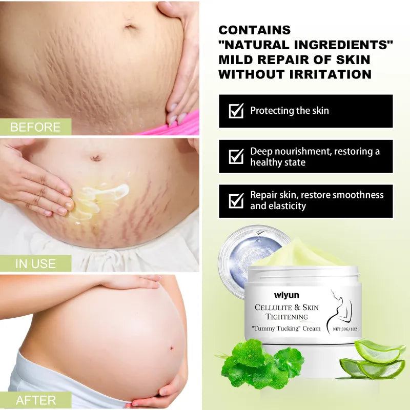 Scar Pregnancy Wound Skin Repair Cream